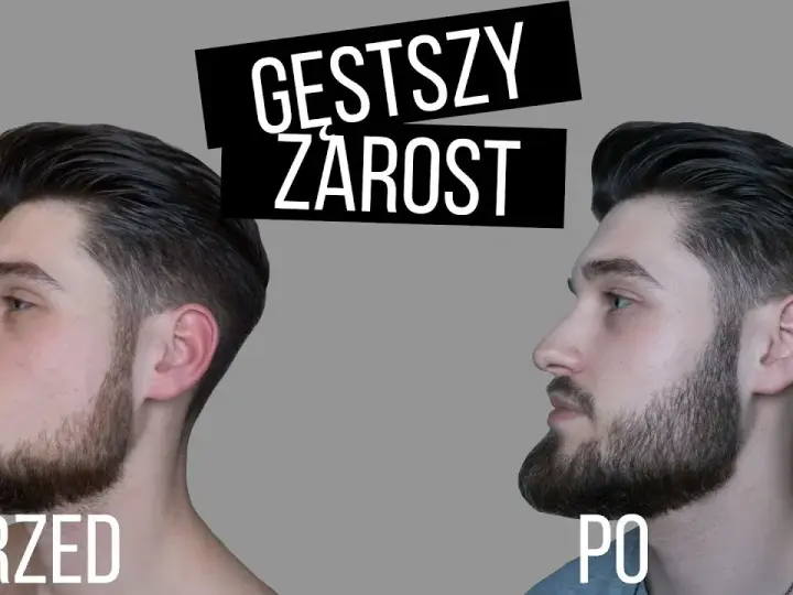 Jak przyspieszyć zarost? Ekspert radzi, co naprawdę działa.