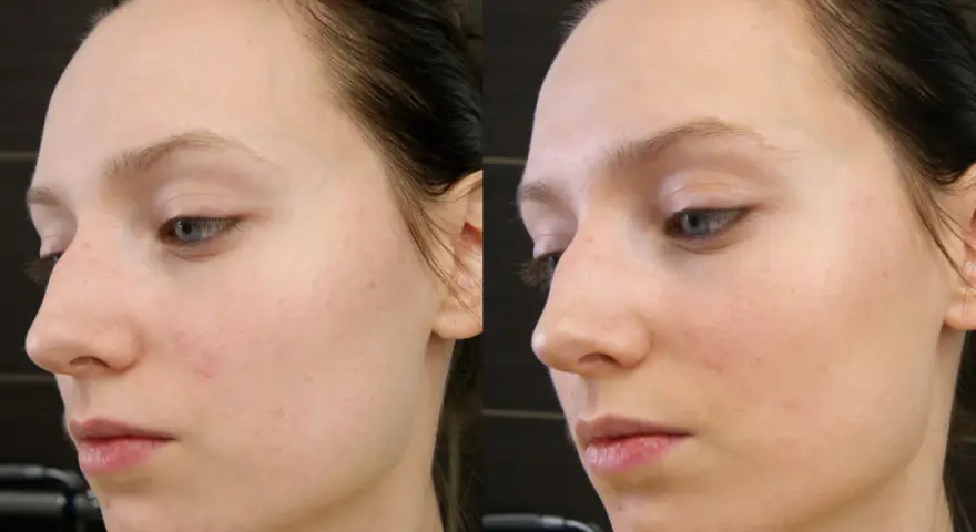 Dr Irena Eris VitaCeric: Rozświetlenie i rewitalizacja. Czy warto?
