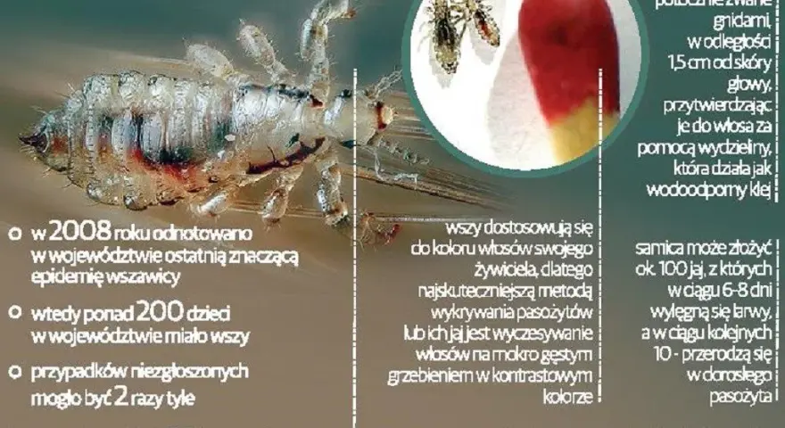 Czy farba zabija wszy? Prawda o gnidach i bezpieczne leczenie
