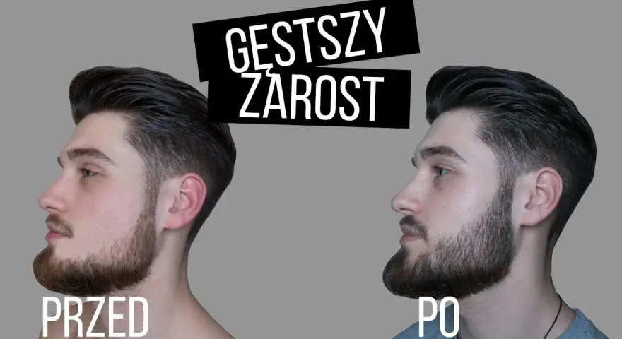 Jak przyspieszyć zarost? Ekspert radzi, co naprawdę działa.