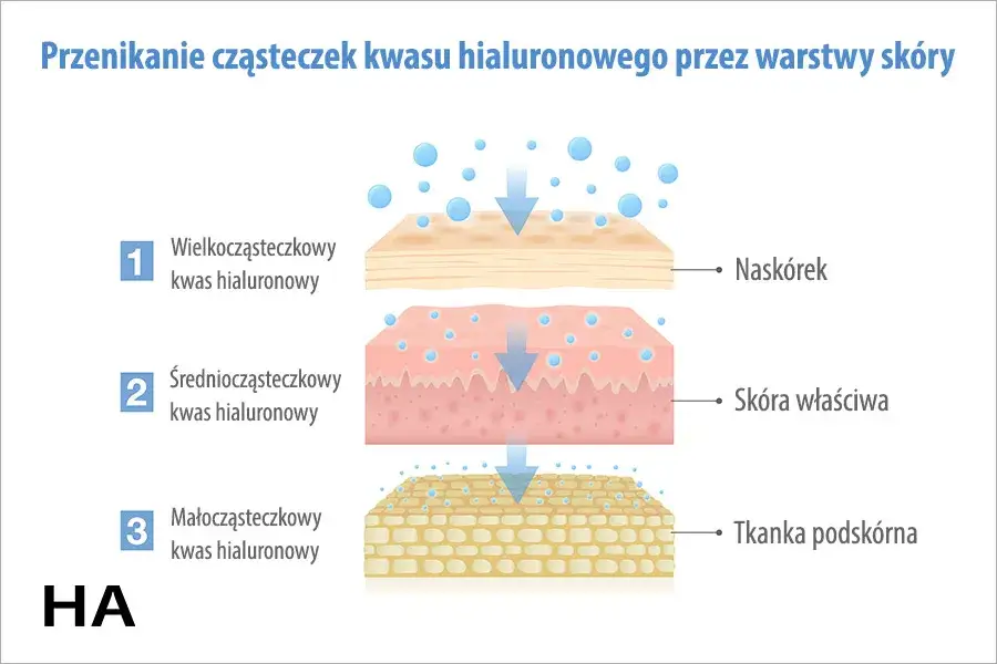 różne masy cząsteczkowe kwasu hialuronowego schemat